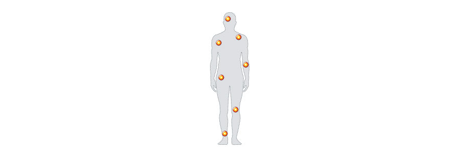 Nurofen targets areas of muscular pain around the body