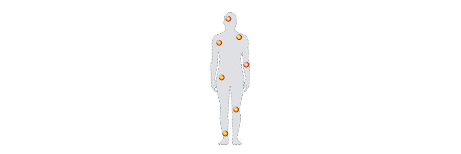 Nurofen targets areas of muscular pain around the body